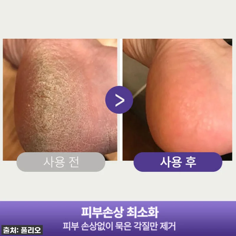 이슈템! 품절임박 풀리오 패디플래너 관련 이미지 3