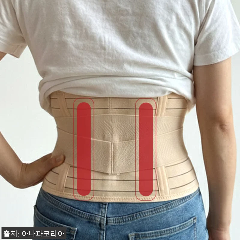 아나파 산후복대 사용후기: 제왕절개 관련 이미지 3