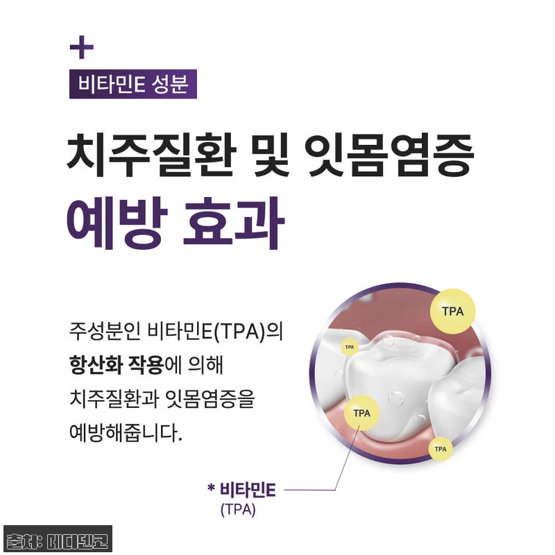 잇몸 고민에 지친 나를 살린 투투스 관련 이미지 5